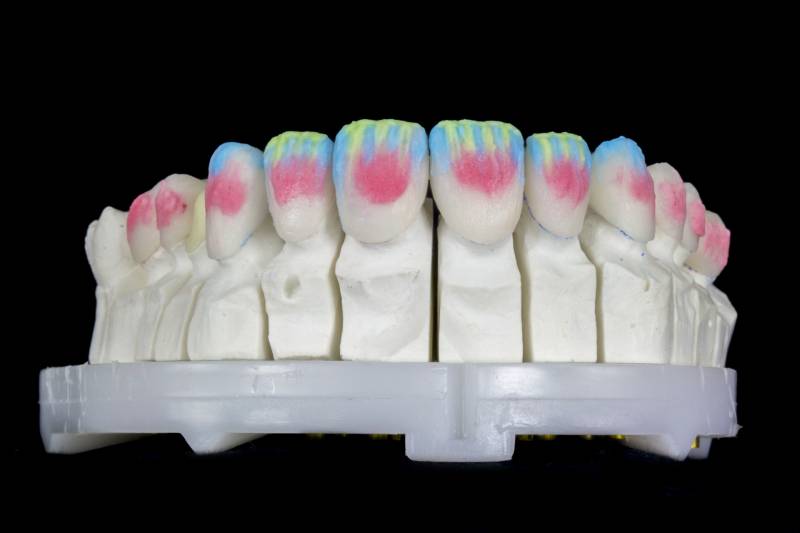 Laboratoire prothésiste dentaire avec technologie CAD-CAM et CFAO à Marseille